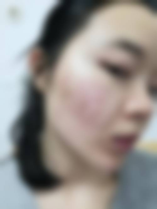 大庆龙南医院医疗美容科怎么样求美者反馈