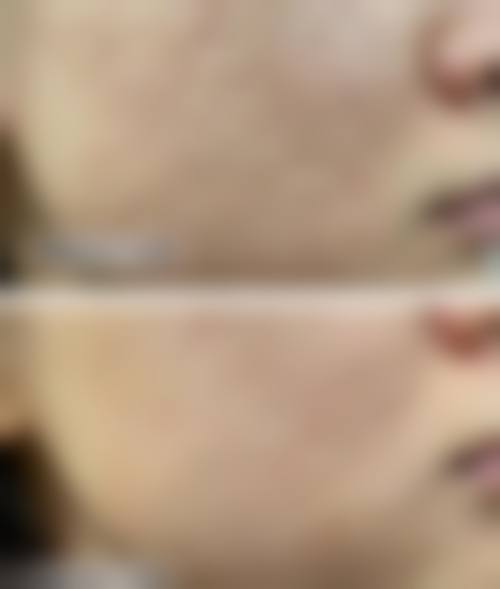 韩国明洞daybeau皮肤科怎么样医生团队实力