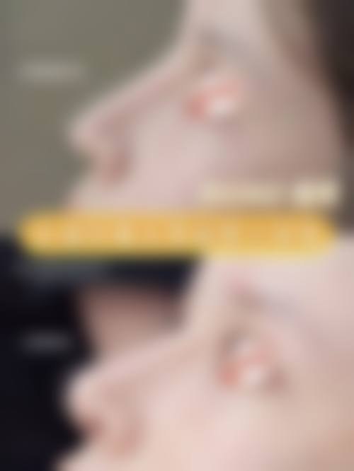 胡顺广医生的专精保护