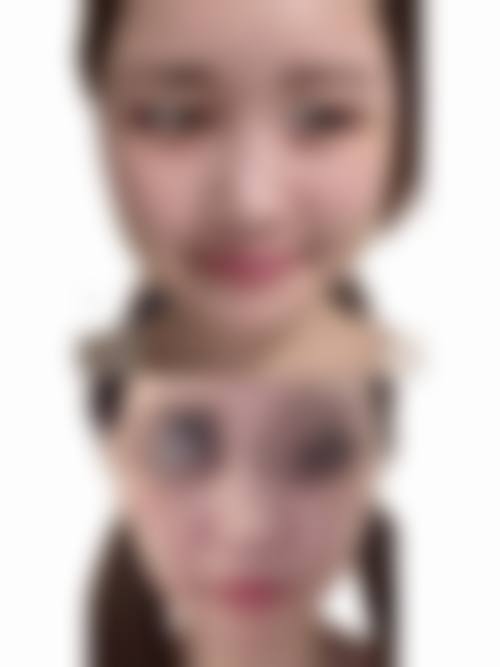 韩国内整形外科怎么样基本信息