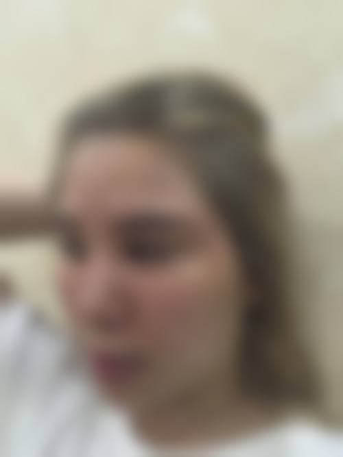 太原灵创医疗美容门诊部怎么样特色项目及技术优势