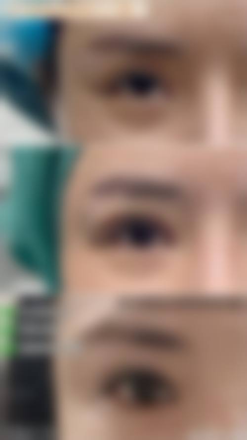 张盛波医生的技术优势