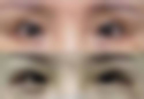 伍恬野医生的成功实例