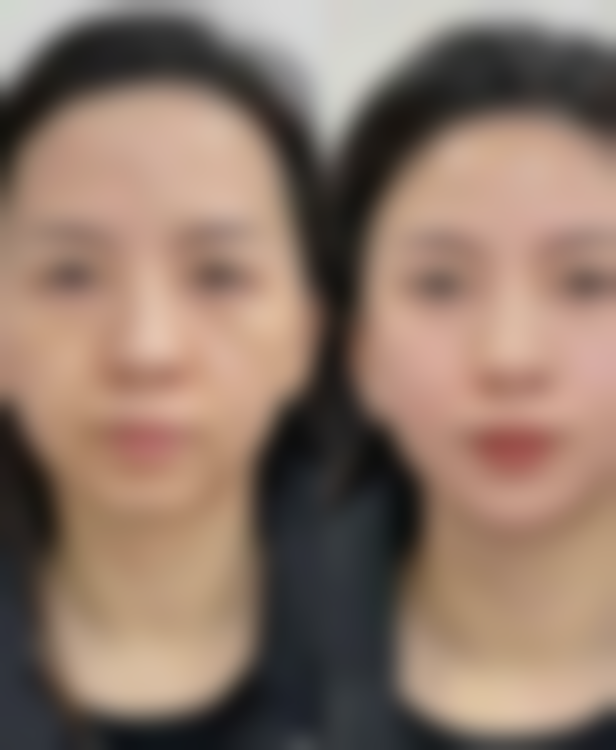 张四文医生擅长的整形项目