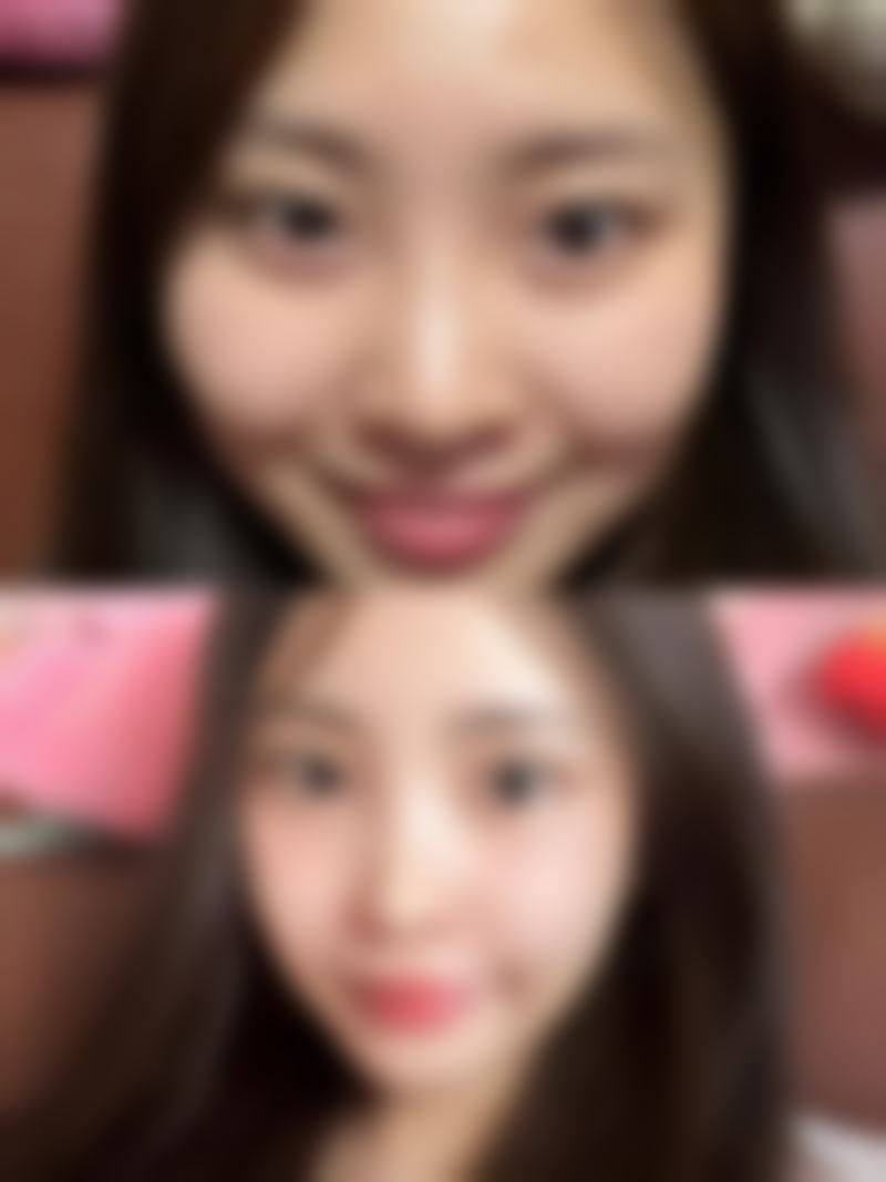 Preecha Tiewtranon医生的成功实例