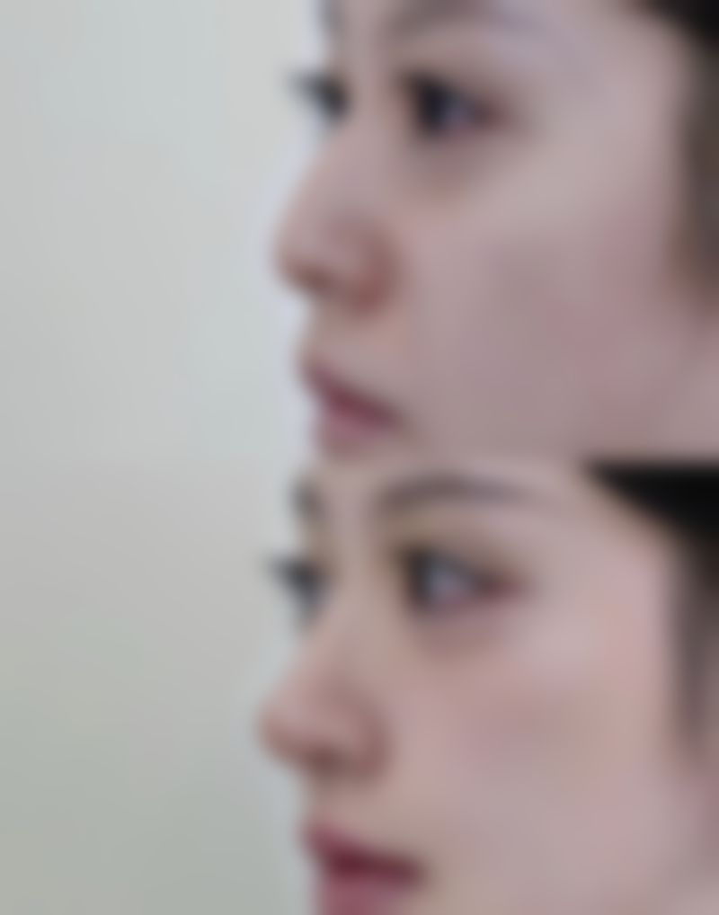 长沙皕诚和隽医疗整形美容医院怎么样求美者反馈