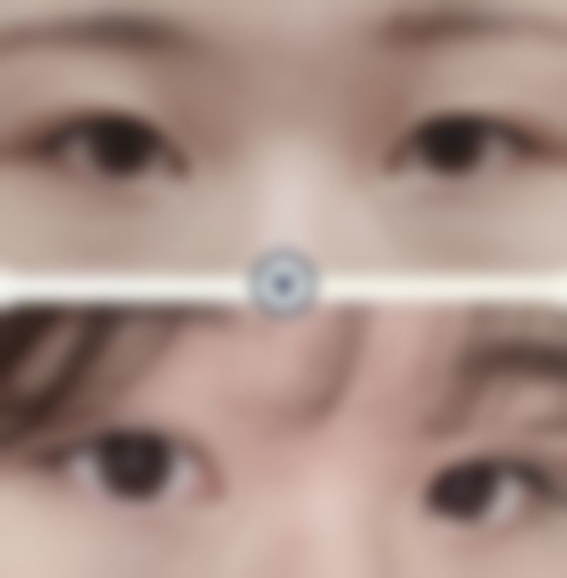 沈阳和平妍泽整形医院怎么样求美者反馈