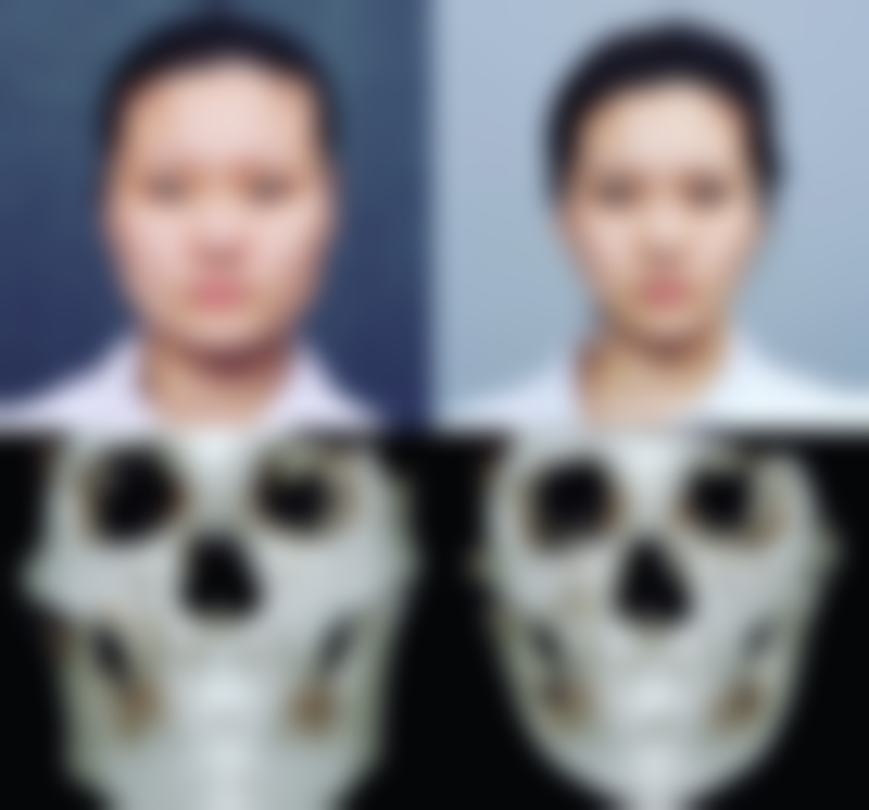 莫梅医生的个性化治疗方案