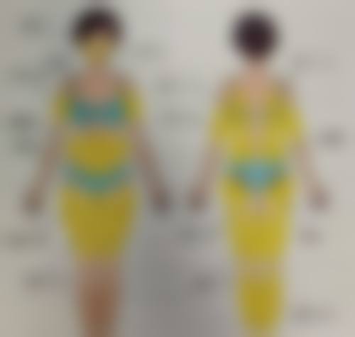 哈尔滨尚美医疗美容门诊部怎么样求美者反馈