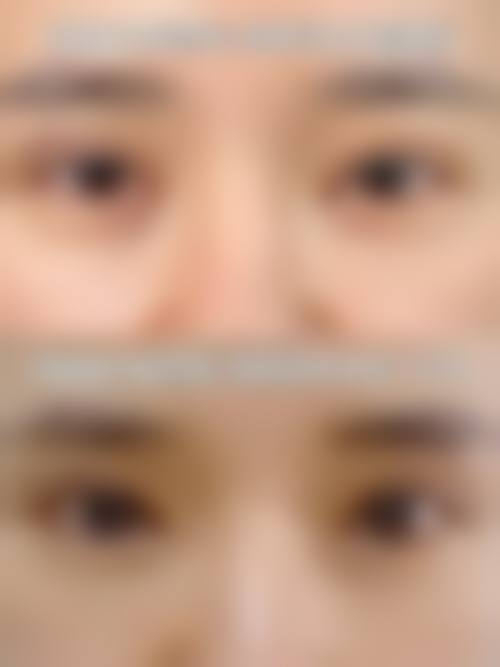 漳州解放军第175医院烧伤整形科求美者反馈