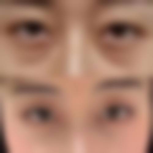 吉文军 医生的微整形与抗衰老技术优势