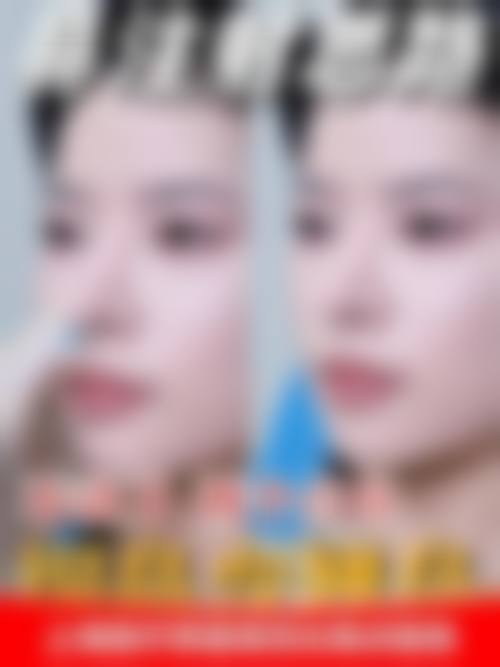 韩炯日医生的成功实例见证实力