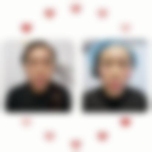 温州艺美整形美容医院怎么样特色项目及技术优势