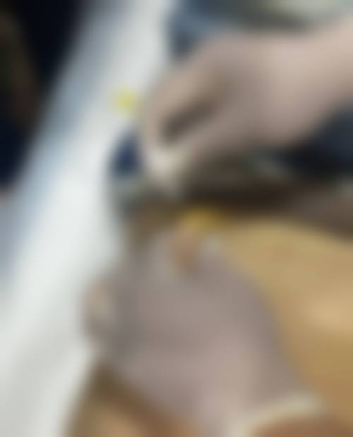 温州艺美整形美容医院怎么样价格收费