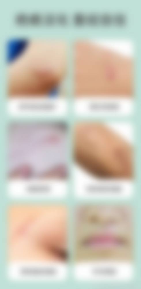 解放军一八一医院医学整形美容科怎么样来院路线