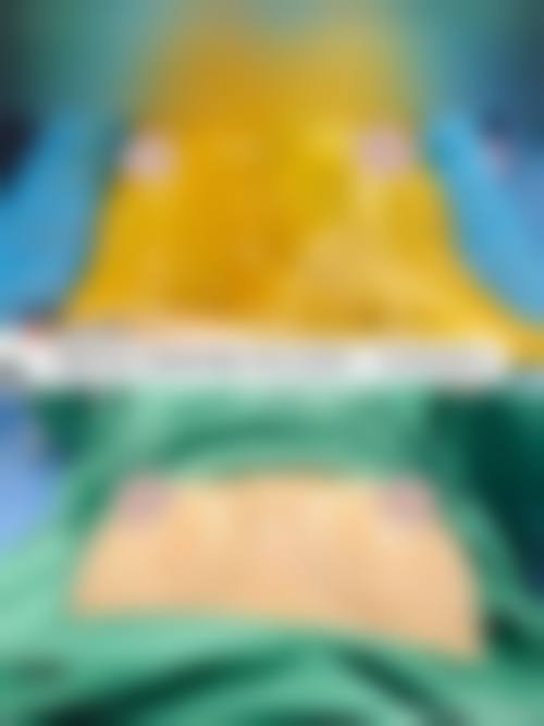 成都天美医疗美容门诊部怎么样求美者反馈