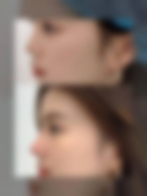 张四文医生的擅长领域