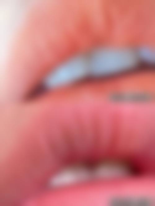 成都蓉美和谐医疗美容门诊部价格收费