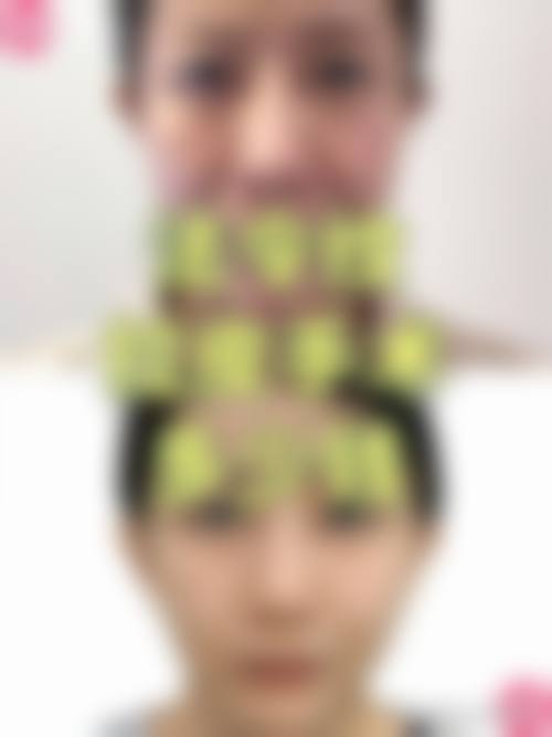 滨州东方美整形医院怎么样求美者反馈