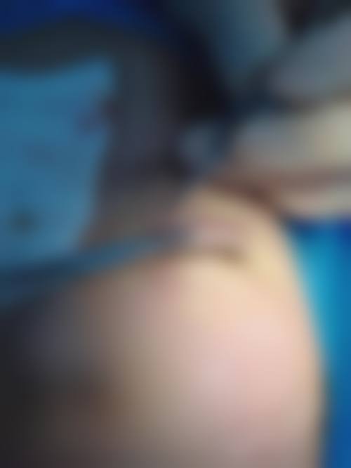 北京聚美仕医疗美容整形医院求美者反馈