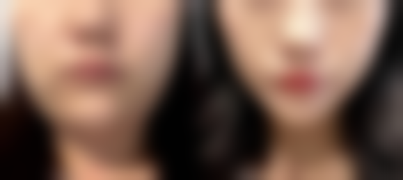 西昌艺佳美医疗整形怎么样求美者反馈