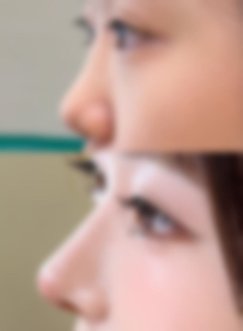 吉文军 医生为爱美者带来的美丽蜕变实例