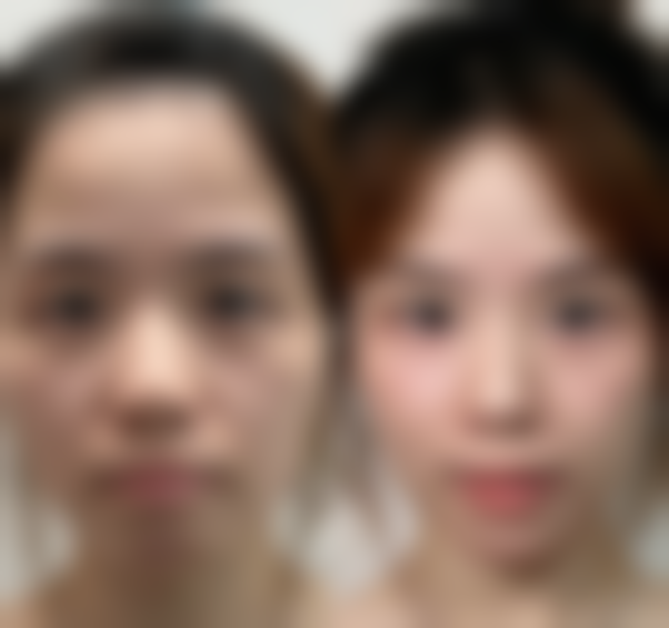 行动起来,找张四文医生开启美丽之旅