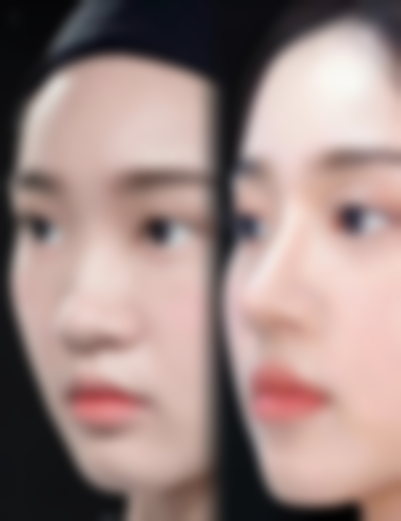 杭州冰美整形医院特色项目及技术优势