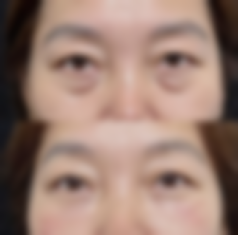 莫梅医生擅长的整形项目