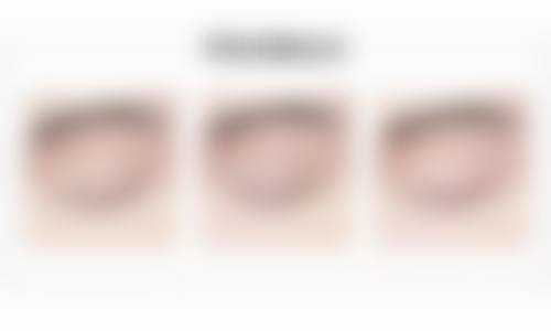 广西 南宁梦想整形医院怎么样特色项目及技术优势