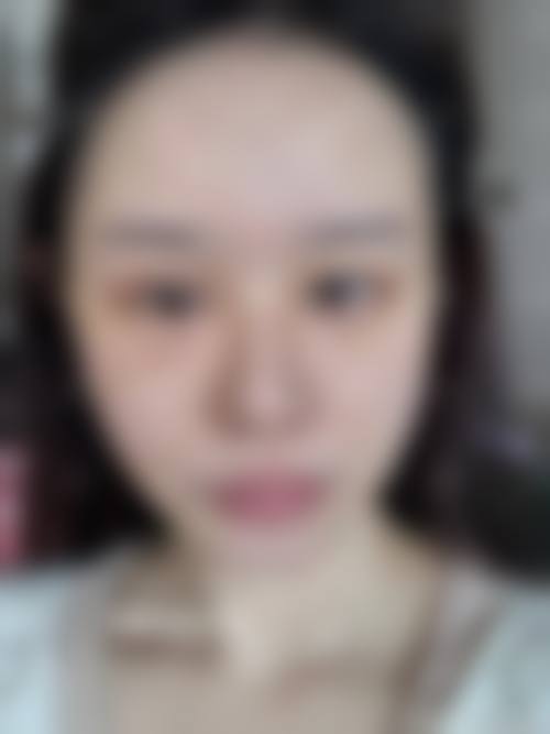 孙玉医生擅长的多元整形项目