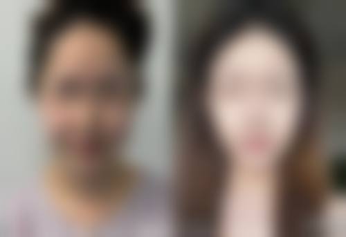 鄂州轻青美整形医院怎么样求美者反馈