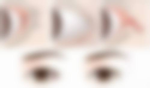 伍恬野医生擅长的项目