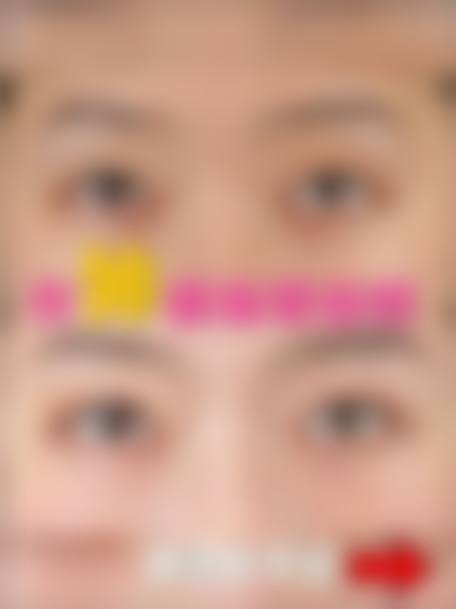 伍恬野医生的专精实力体现