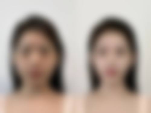 深圳睿美医疗美容诊所怎么样特色项目及技术优势