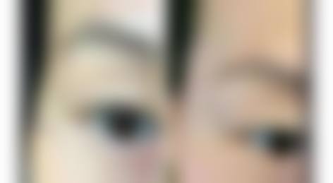 新疆千禧丽人整形美容医院特色项目及技术优势