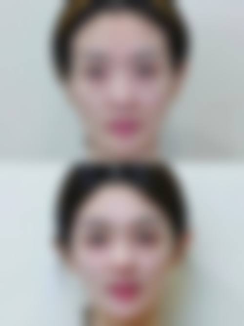 西畴容貌肌因整形医院怎么样价格收费