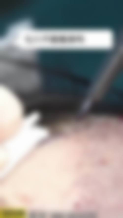 吉文军 医生的专精团队与技术迭代能力