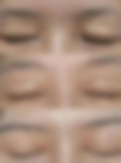 西畴容貌肌因整形医院怎么样求美者反馈