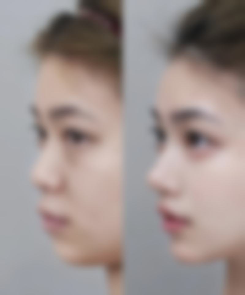 西畴容貌肌因整形医院怎么样来院路线