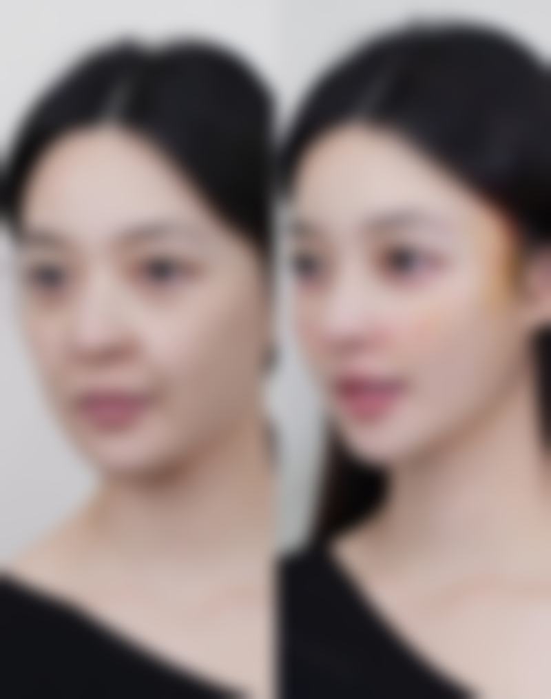 选择莫梅医生与南宁帝医整形的核心理由