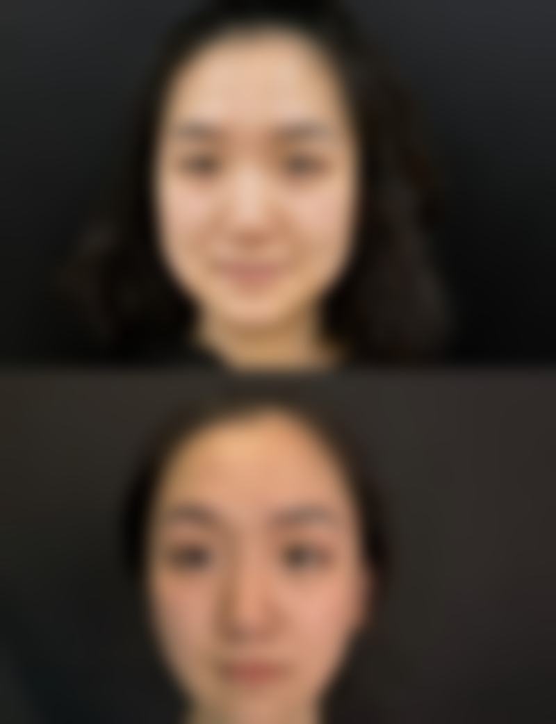 郑州市第一人民医院(整形外科)怎么样求美者反馈