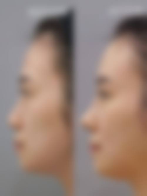 东莞君熠整形医院怎么样价格收费