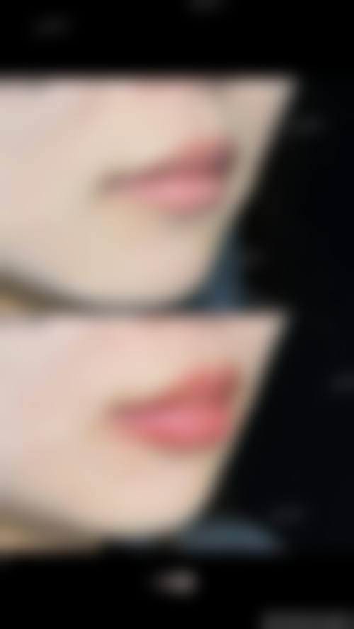 北京华悦府医疗整形美容医院怎么样求美者反馈