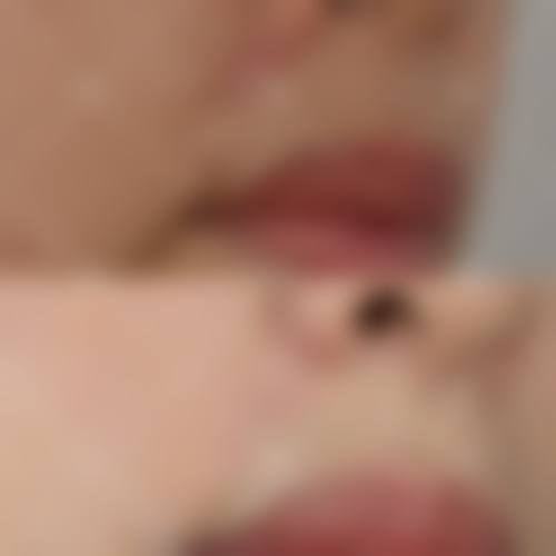 医美项目参考价格与预约方式