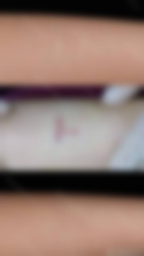 张盛波医师覆盖的核心医美项目