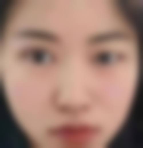 衡阳美莱整形医疗美容医院求美者反馈