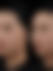 东莞君熠整形医院怎么样来院路线