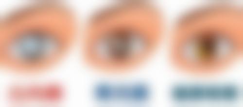 jw眼科怎么样简介概述