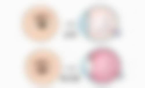 jw眼科怎么样特色项目及技术优势